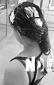 <p>    傷者頭部被砸出多個(gè)血洞。 通訊員杜亞軍南都記者徐文閣 攝</p>
