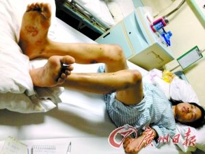 東莞女子被懷疑不忠 遭男友虐待兩晝夜