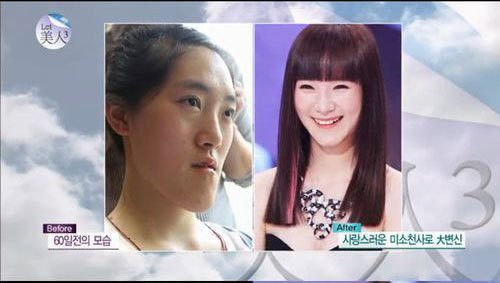 中國“恐龍女”上韓國整容節(jié)目變芭比娃娃