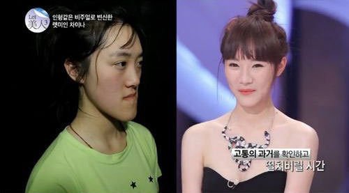 中國“恐龍女”上韓國整容節(jié)目變芭比娃娃