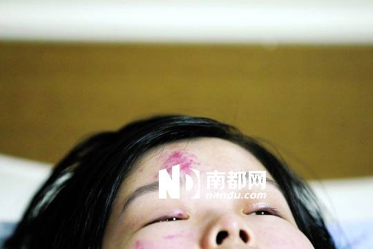 <p>    昨日，白巍在寶安人民醫(yī)院病房接受治療。南都記者 徐文閣 攝</p>