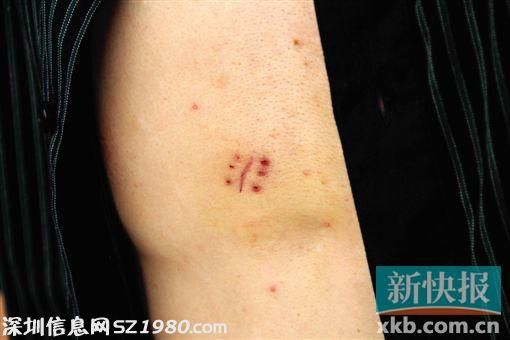 廣州司機(jī)開(kāi)著車(chē)窗 突見(jiàn)尖刀伸進(jìn)來(lái)架脖搶劫