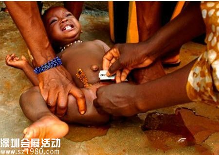 非洲女孩割禮 親貝網(wǎng)