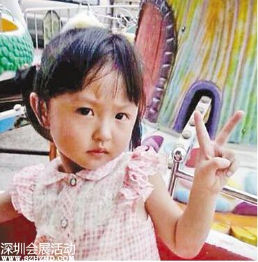 女孩跌進(jìn)熱油桶 父親脫其衣服揭掉表皮致二次傷害
