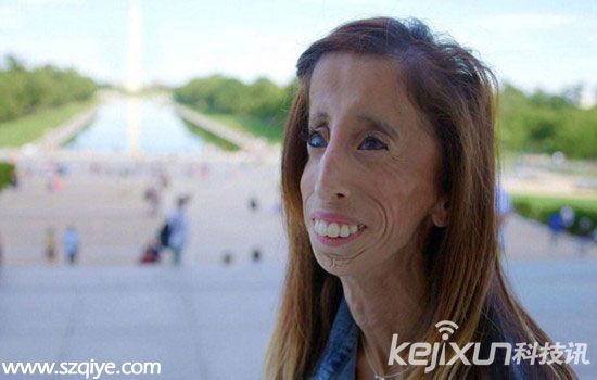 世界上最丑女人幼年飽受凌辱 網(wǎng)友曾評為何不燒死