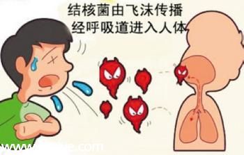 寶安區(qū)15歲以上常住居民可免費(fèi)查結(jié)核病
