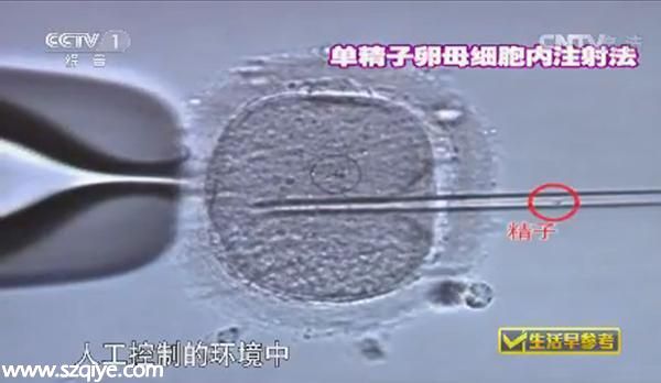億萬富婆戀上醫(yī)生試管造人 5年后又冒出代孕兒子