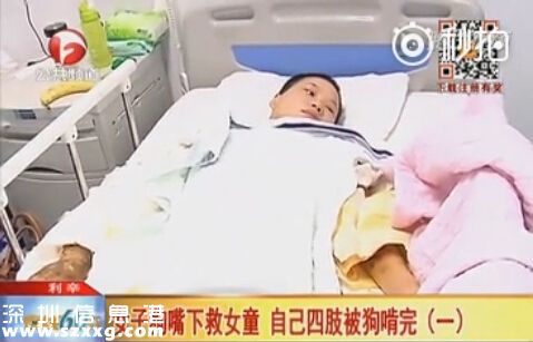 女子從惡狗口中救女童 自己四肢慘被啃完