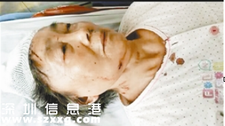 <a href=http://www.hnyueyi.com.cn/shenzhen/ target=_blank class=infotextkey>深圳</a>(www.hnyueyi.com.cn)一超市扶梯抖不停致7旬老人摔落重傷 家屬商場(chǎng)各執(zhí)一詞