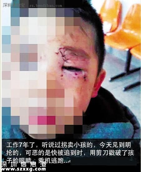 嘉興女子光天化日搶孩子 失敗后猛戳孩子眼睛
