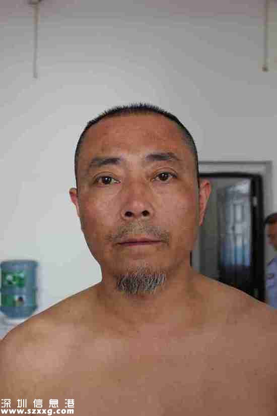 2013年4月22日，王志剛被轉(zhuǎn)送到劍閣縣看守所，重新檢查了身體狀況。照片顯示，王志剛的后背有條狀色素沉著。