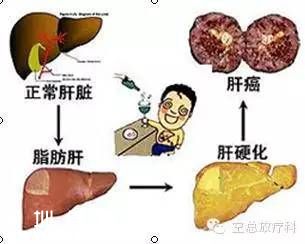 港大深圳(www.hnyueyi.com.cn)醫(yī)院開設肝癌門診 多位資深專家坐診