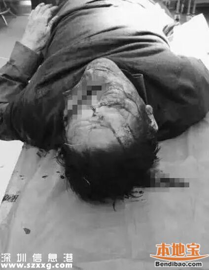 安徽醫(yī)生被砍死 事發(fā)時(shí)醫(yī)生正在睡覺(jué)
