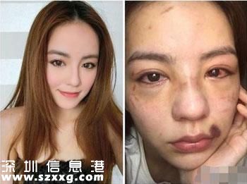 港姐被打成豬頭