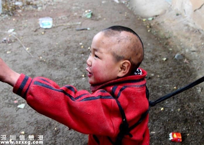 兄妹倆被拴豬圈邊 腦癱兄妹無錢治病好心塞(圖)