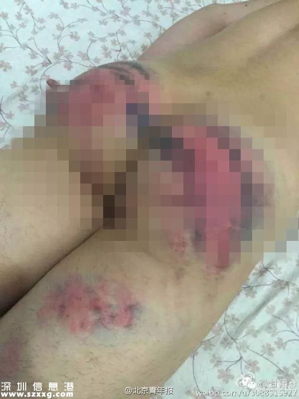 警方回應(yīng)“蘭州民警暴打大學(xué)生”：派出所長停職