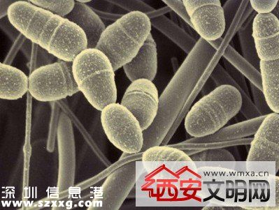 美國發(fā)現(xiàn)無敵細(xì)菌無藥可治 若擴(kuò)散人類或?qū)⒃馐軠珥斨疄?zāi)