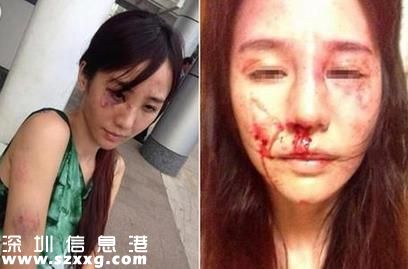 合肥女律師遭家暴 多次求饒丈夫仍未罷手(組圖)