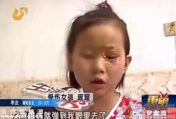 音樂蠟燭突然爆炸 小姑娘眼瞼皮膚燙傷（組圖）