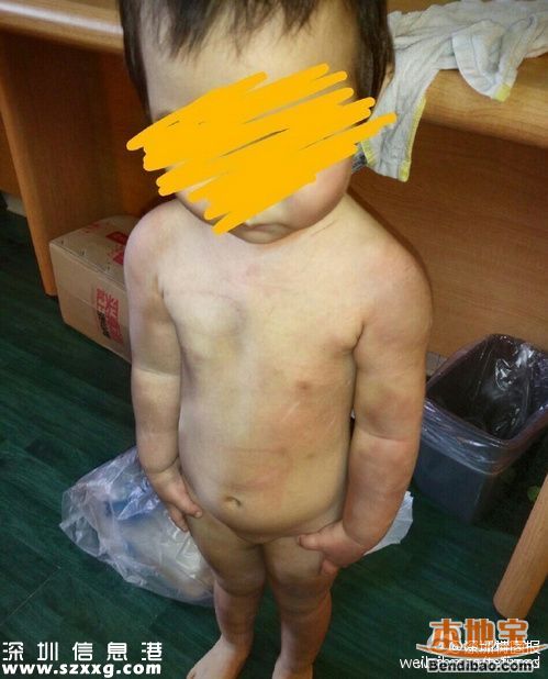 親生父親虐待女兒打出血 發(fā)圖給前妻炫耀(圖文)