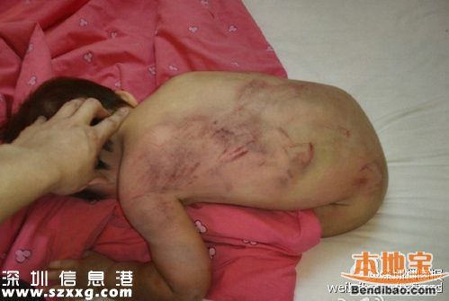 親生父親虐待女兒打出血 發(fā)圖給前妻炫耀(圖文)