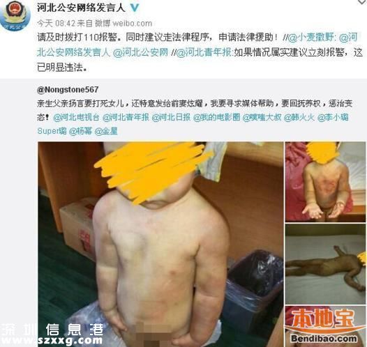 親生父親虐待女兒打出血 發(fā)圖給前妻炫耀(圖文)