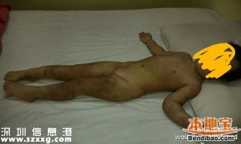 親生父親虐待女兒打出血 發(fā)圖給前妻炫耀(圖文)