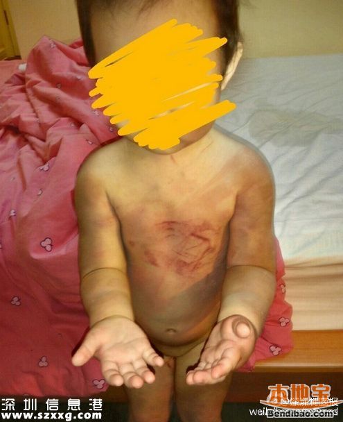 親生父親虐待女兒打出血 發(fā)圖給前妻炫耀(圖文)