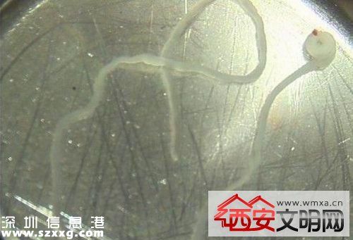 吉安籍男童腦里長寄生蟲 發(fā)現(xiàn)面部及右側(cè)肢體抽搐后送醫(yī)治療