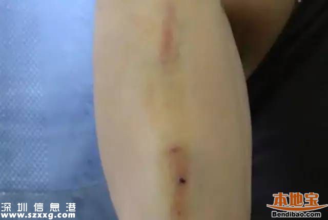 深圳3女子拒絕鄰座敬酒被打 被酒瓶椅子砸頭