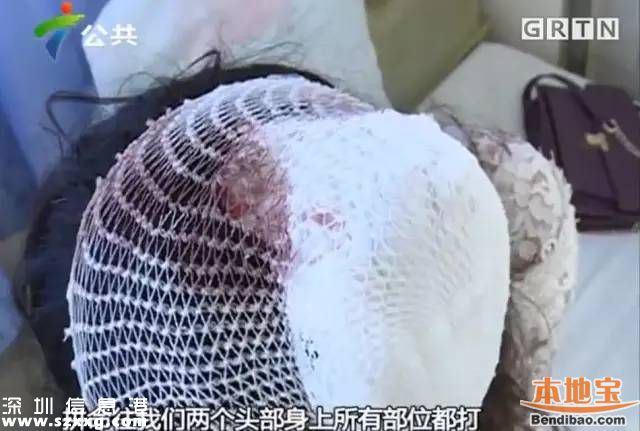 深圳3女子拒絕鄰座敬酒被打 被酒瓶椅子砸頭