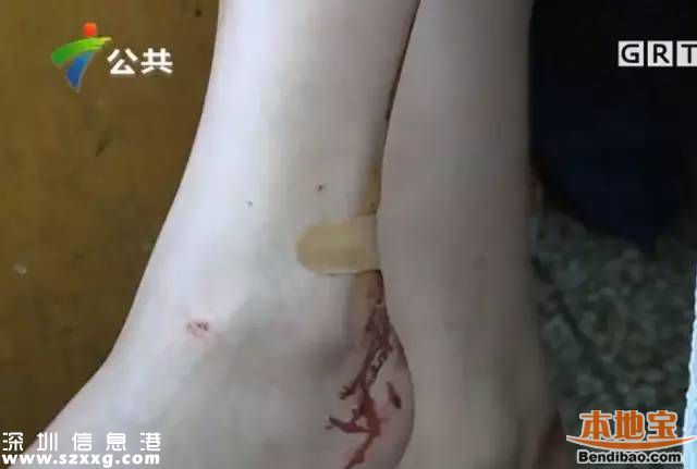 深圳3女子拒絕鄰座敬酒被打 被酒瓶椅子砸頭