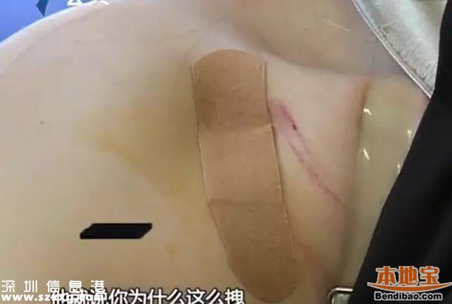 深圳3女子拒絕鄰座敬酒被打 被酒瓶椅子砸頭