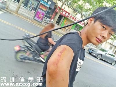 鄭州騎電動(dòng)車小伙被線纜勒住脖子掛翻 生命垂危