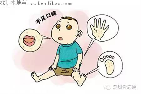 深圳手足口病疫苗來了！寶安鹽田南山開始供應(yīng)