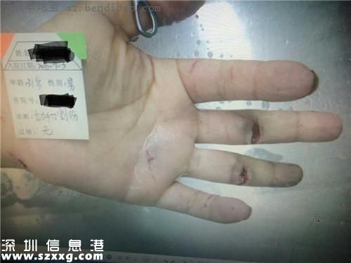 深圳滴滴司機遭乘客搶劫 被割傷還將被追責(zé)