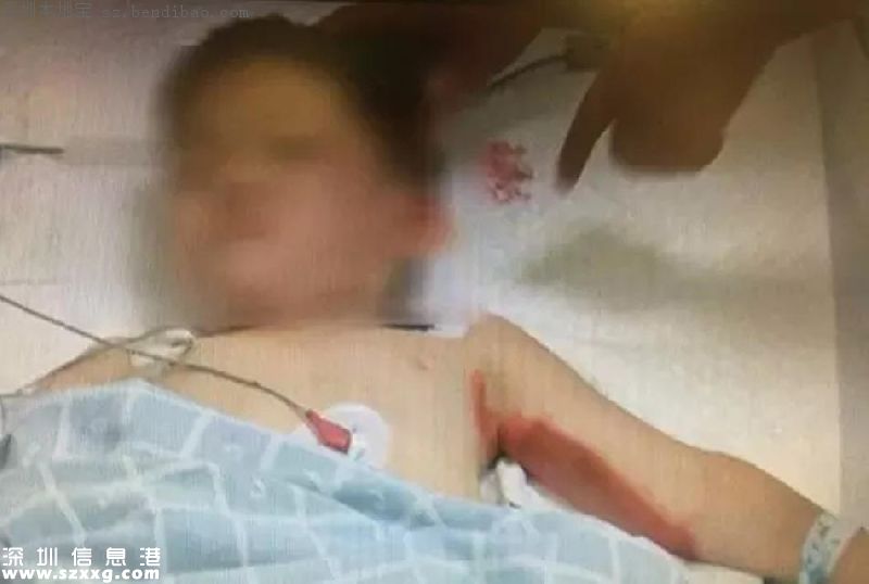 深圳司機碾壓3兒童續(xù)：未酒駕 正調(diào)查是否看手機
