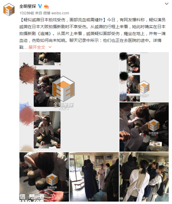 戚薇日本拍戲受傷畫面 竟自嘲人在江湖飄哪有不挨刀