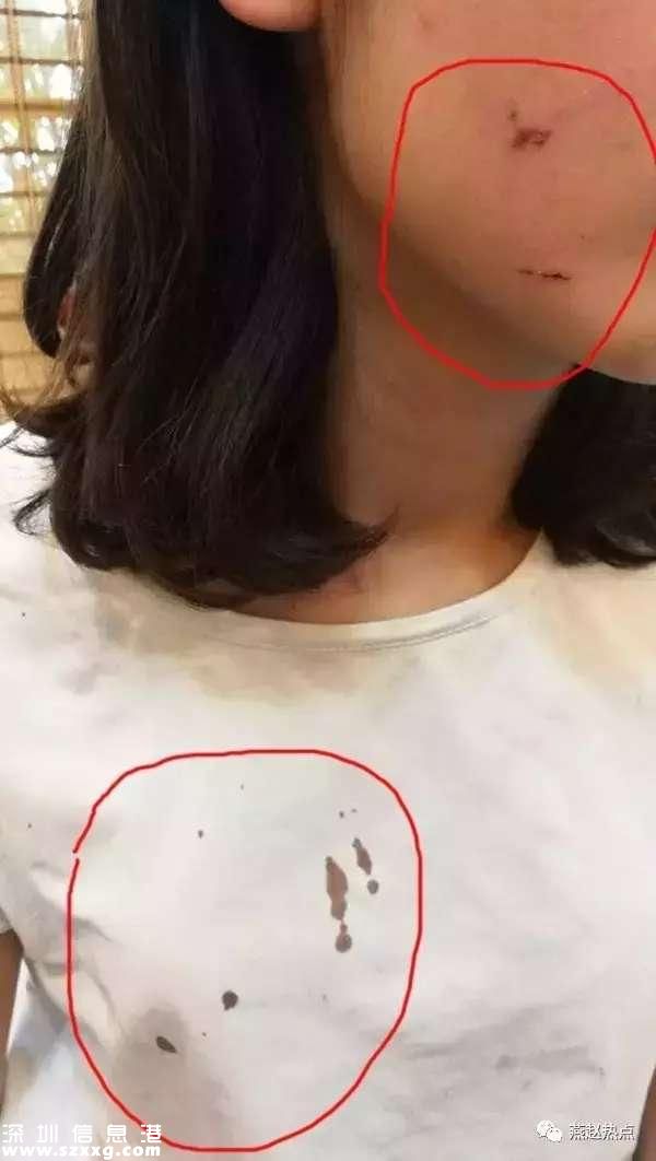 少女被騙ktv毒打 被威脅不愿陪客就放血(組圖)