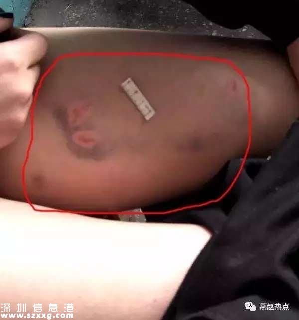 少女被騙ktv毒打 被威脅不愿陪客就放血(組圖)